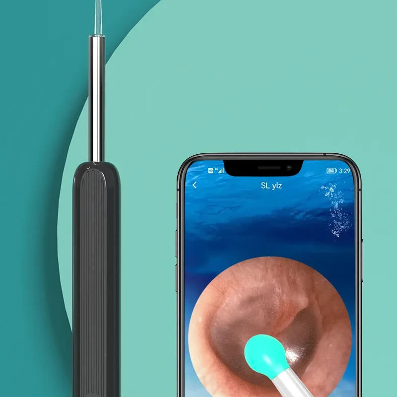 Smart EarWax Cleaner - HD Visual WiFi Ear Pick